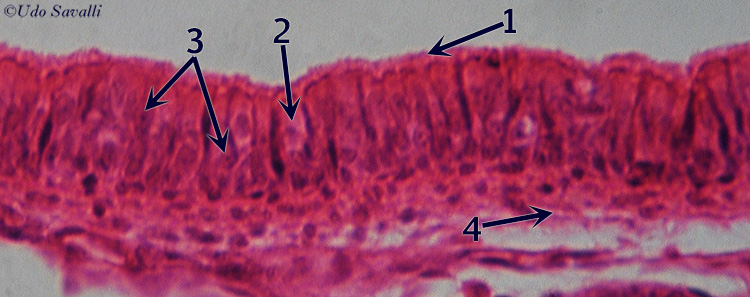 pseudostratified columnar