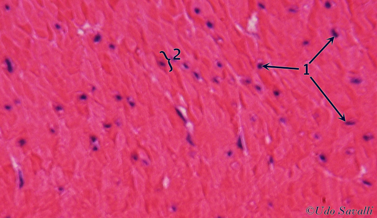 Smooth muscle cs