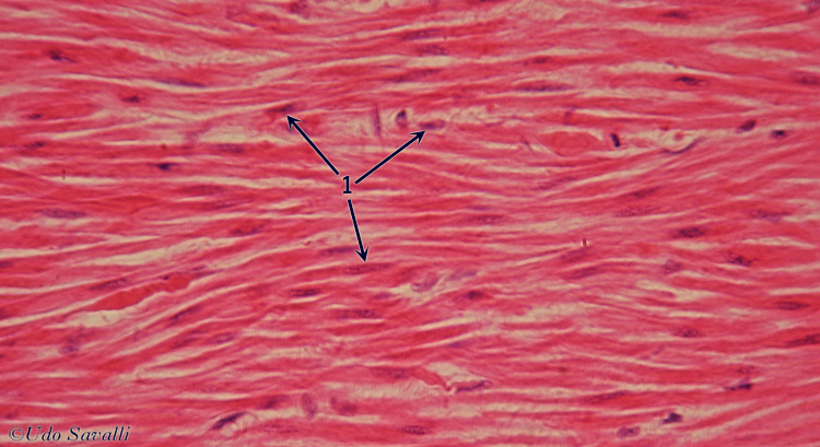 Smooth muscle ls