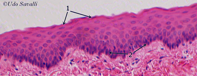 stratified squamous epith