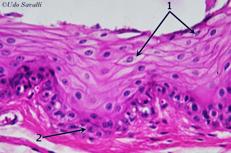 stratified squamous epith