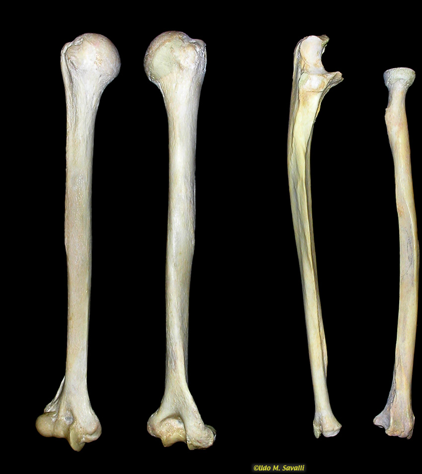 Upper limb bones unlabeled