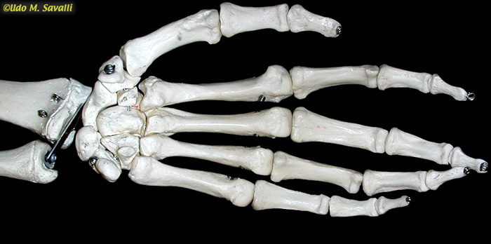 Hand bones, palmar view unlabeled