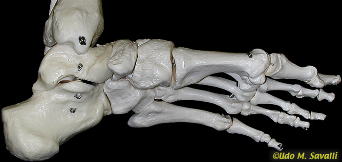 Foot bones, medial view unlabeled
