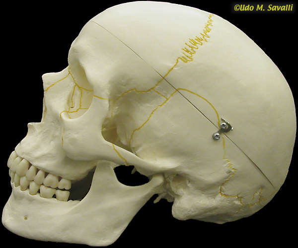 Side of skull unlabeled