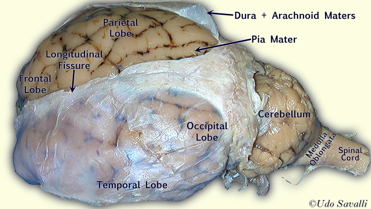 Sheep Brain external view labeled