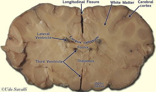 Sheep Brain frontal section labeled