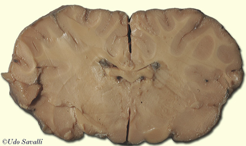 Sheep Brain frontal section unlabeled
