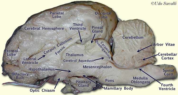 Sheep Brain internal view labeled