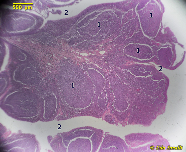 tonsil Histology