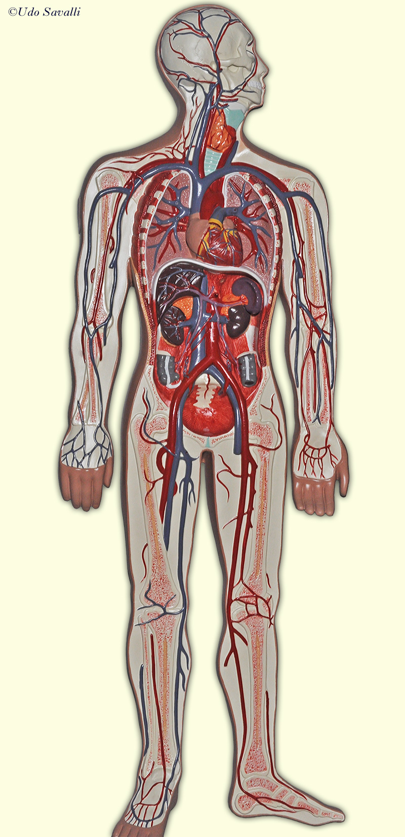 charge syndrome blood vessels