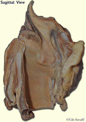 sheep Larynx sagittal sect. unlabeled