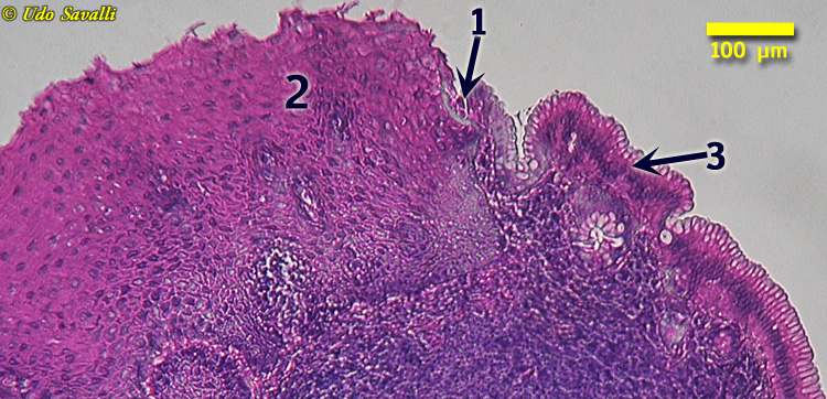 Gastroesophageal Jct Histology